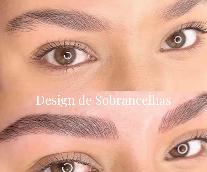 PREENCHIMENTO LABIAL (5)
